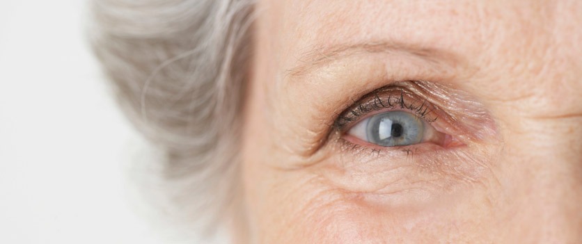 Entzündung der Lidränder: Auge einer älteren Frau in der Nahaufnahme.